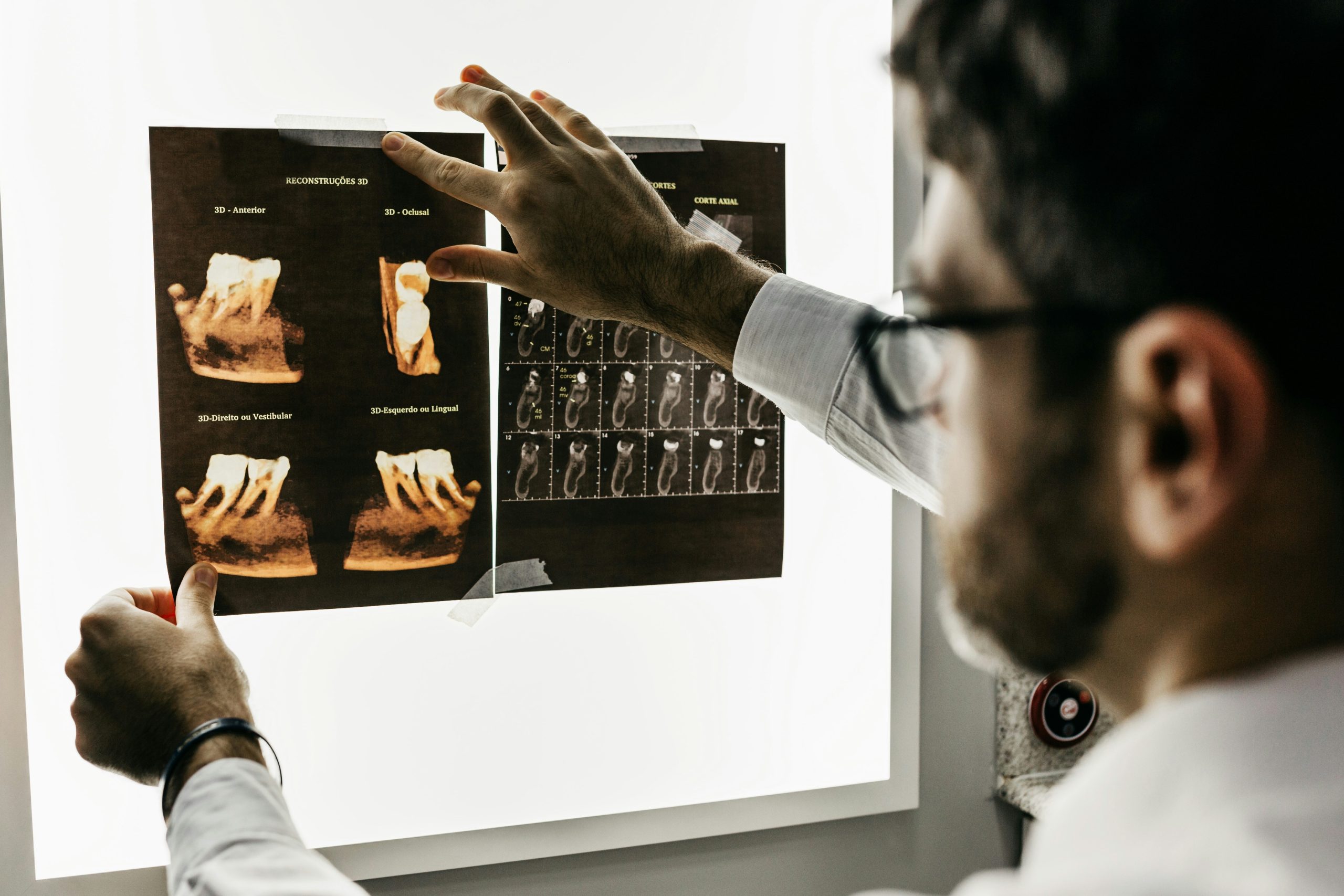 dental implant surgery
